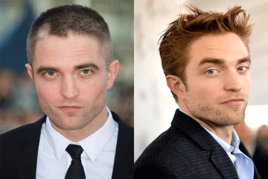 Stars Without Their Toupees Male celebrities who