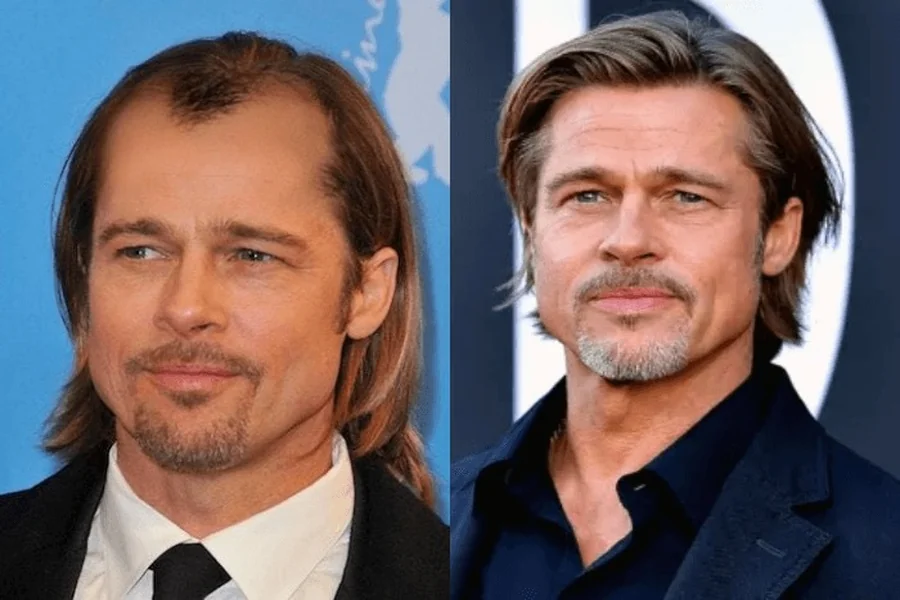 Stars Without Their Toupees Male