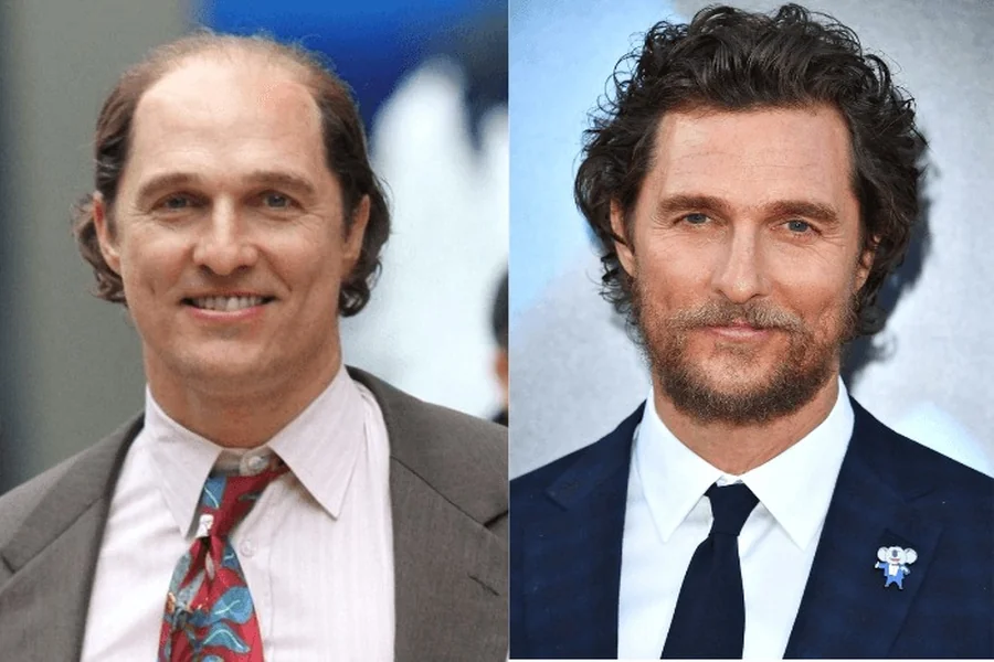 Stars Without Their Toupees