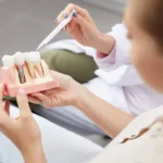 What Seniors Should Know Before Getting Dental Implants