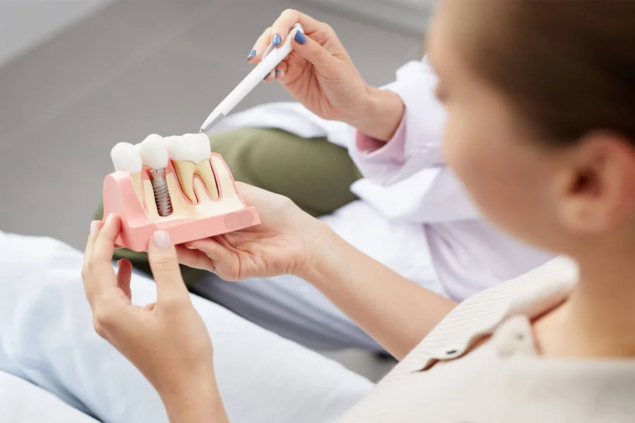 What Seniors Should Know Before Getting Dental Implants